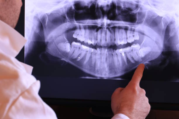Best Emergency Treatment for Toothache in Neodesha, KS