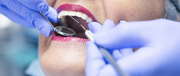 Best Emergency Wisdom Teeth Removal in Neodesha, KS